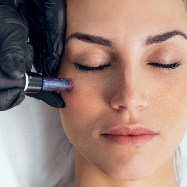 How to Choose the Best Microneedling in Brisbane for Healthier, Stronger Skin
